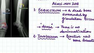 sequestrum involucrum and cloacae [upl. by Brosine]