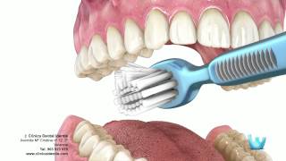 Higiene dental  Clinica identis [upl. by Adikram]