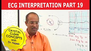 EKG or ECG Interpretation  Part 1920 [upl. by Antons952]