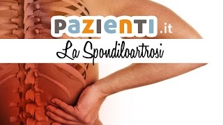 La spondiloartrosi sintomi cause e cure [upl. by Olenta]