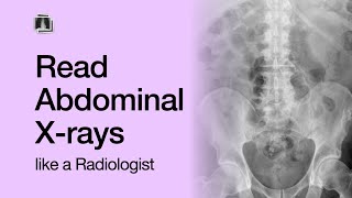 How to Read an Abdominal XRay [upl. by Markiv317]