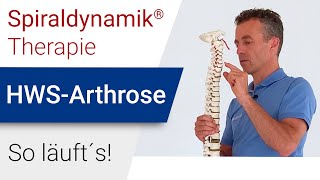 Spiraldynamik® Therapie HWSArthrose [upl. by Anile]