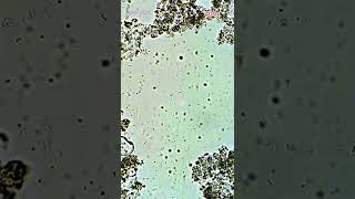 Probiotics Under Microscope Activia Yogurt [upl. by Zorana]