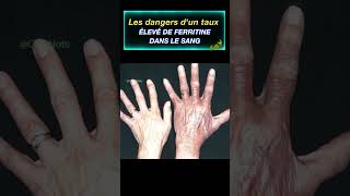 Les dangers dun taux élevé de ferritine dans le sang  Fact24h [upl. by Joellyn336]