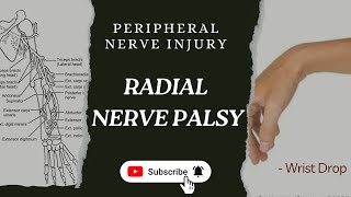 Radial Nerve Palsy  Radial nerve injuryPeripheral nerve injury  Clinical Neurology  Orthopedics [upl. by Hasty489]