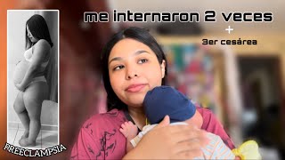 Story time  PREECLAMPSIA SEVERA🤰🏽 CESÁREA DE EMERGENCIA🚨 [upl. by Beitch]