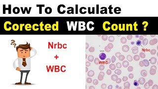 Corrected WBC Count  Clear Explain [upl. by Spiers76]