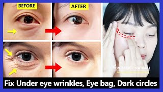 Only 6 mins Eye rejuvenation Get rid of under eye wrinkles dark circles eye bags Crows feet [upl. by Nahshu]