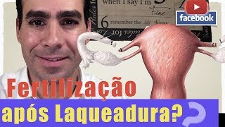 🔴AOVIVO Fertilização invitro após LAQUEADURA [upl. by Ttelracs]