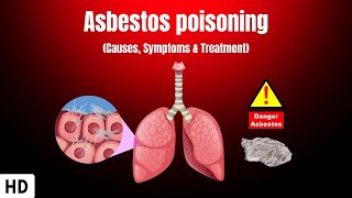 Asbestos Poisoning Causes Symptoms and Treatment [upl. by Nnaer]