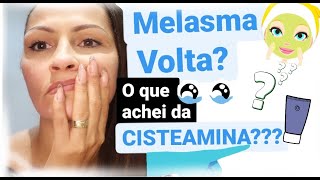 MELASMA RESULTADO DA CISTEAMINA [upl. by Eilram]