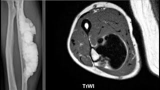 MSK Radiology Spotters radiopediafrcrctmrixraybonestipsamptricksmusculoskeletalexamscases [upl. by Cyndia]