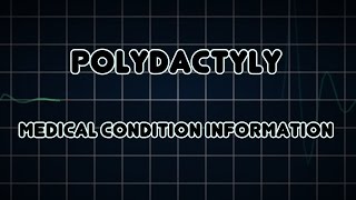 Polydactyly Medical Condition [upl. by Aremahs]