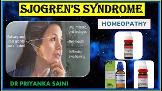 Sjogren’s Syndrome  Homeopathy Treatment  dry eye  dry mouth drpriyankashomeopathy [upl. by Ajet]