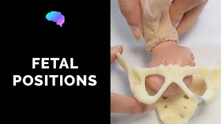 mechanism in occipito posterior position explained in hindi [upl. by Nwahsor]