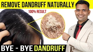 How To Treat Dandruff at Home  Get Rid of Dandruff Naturally at Home  Dr Vivek Joshi [upl. by Nabatse425]