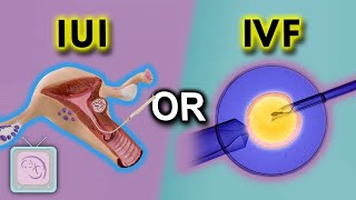 IUI vs IVF for sperm problems 5 ways to decide [upl. by Avilys]