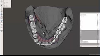 Full Arch Digital Dental WaxUp in MeshMixer [upl. by Oretna]