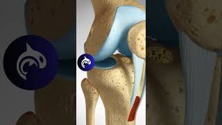 ACL Reconstruction  Patellar Harvest  3D Animation knee kneepain kneerehab [upl. by Nigrom]