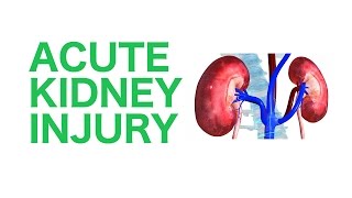 Acute Kidney Injury AKI  USMLE [upl. by Rimat]