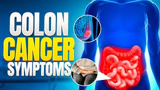 RECOGNISE COLON CANCER TO CATCH IT ON TIME [upl. by Nhepets49]