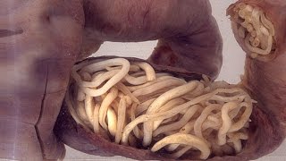 Top 10 Human Intestine Parasites Narrated [upl. by Lussi]