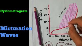 Cystometrogram  Micturition waves  Renal system 46 [upl. by Nireil]