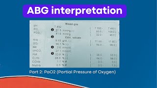 ABG Interpretation PaO2 Partial pressure of Oxygen [upl. by Areic5]