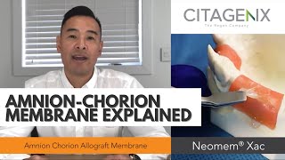 NEW AmnionChorion Membrane for Dental Oral Maxillofacial Surgeries  Citagenix [upl. by Annaehs]