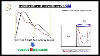 PULSE basics amp ABCD pulse  Internal medicineCardiology focused on FMGENEXT amp NEETPG [upl. by Ecniuq]