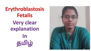 Erythroblastosis Fetalis in Tamil  Very clear explanation ✨ [upl. by Fritts]