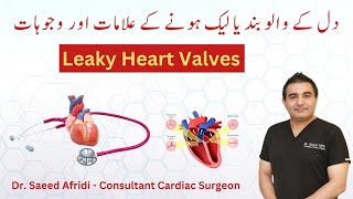 Leaky Heart Valves  Causes and Symptoms  HindiUrdu [upl. by Auhsej119]