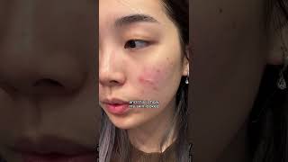 best korean skincare products to restore damaged skin barrier I MANYO BIFIDA TONER amp AMPOULE shorts [upl. by Aleakim]