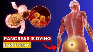 6 Symptoms of PANCREATIC CANCER That Will SHOCK YOU  Critical Warning Signs [upl. by Marshal69]