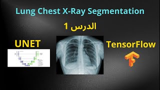 الدرس الأول في Lung Chest XRay Segmentation بإستخدام UNET amp TensorFlow [upl. by Eibbob30]