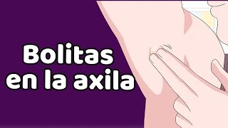 LA PROTUBERANCIA AXILAR causas síntomas tratamiento [upl. by Bodnar]