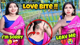 Kissing Prank Gone Wrong💔 Found Love Bite💋🤬Ankur000 [upl. by Wald]