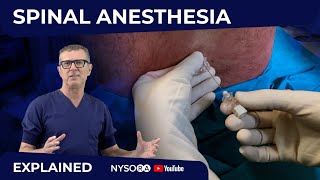 Spinal Anesthesia Explained Part 1 Crash course with Dr Hadzic [upl. by Aver687]