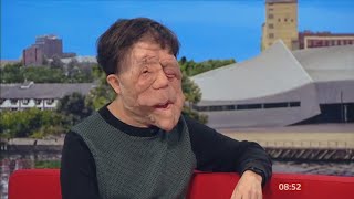 A Different Man ADAM PEARSON interview 2024 [upl. by Adnulahs51]