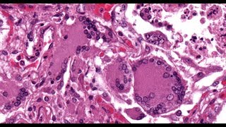 Canine Distemper Hyperkeratosis Meningoencephalitis Enamel Hypoplasia  Part 2 [upl. by Ennairol]