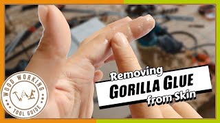 Unstick the Mess Removing Gorilla Glue from Skin  DIY Guide [upl. by Gardener]