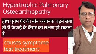 Hypertrophic pulmonary osteoarthropathy causes symptoms diagnosis Treatment pathology [upl. by Ahtivak198]