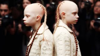 Meet The Rarest Black Twins In The World [upl. by Coppins]