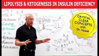 Lipolysis and Ketogenesis in severe Insulin Deficiency👨‍⚕️ [upl. by Ganiats]