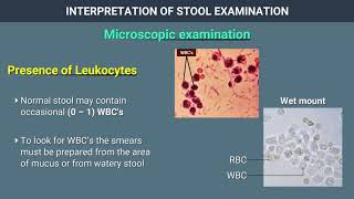 Interpretation of Stool Examination [upl. by Eniledam]