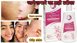 Calmac calamine lotion review in hindi 2022 चेहरे की चमक लाने की क्रीम open Sporesitching glow [upl. by Ecniv]