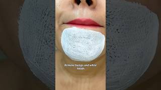 Remove black and white heads from nose and chin shorts short trending trendingshorts viral fyp [upl. by Eislrahc]