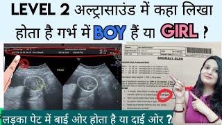 Level 2 ultrasound me kaha likha hota hai BOY hoga ya GIRL  Ladka or Ladki [upl. by Ramled]