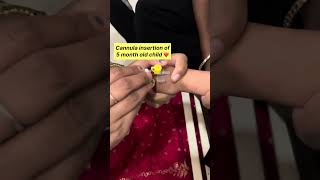 Cannula insertion of 5 month old child Cannulation nurses mbbs medicalprocedure bscnursing [upl. by Lienhard]