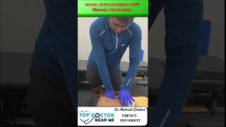 Naval Displacement नाभि खिसकना Treatment is possible through Visceral Osteopathy [upl. by Onin]